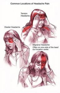 migrain